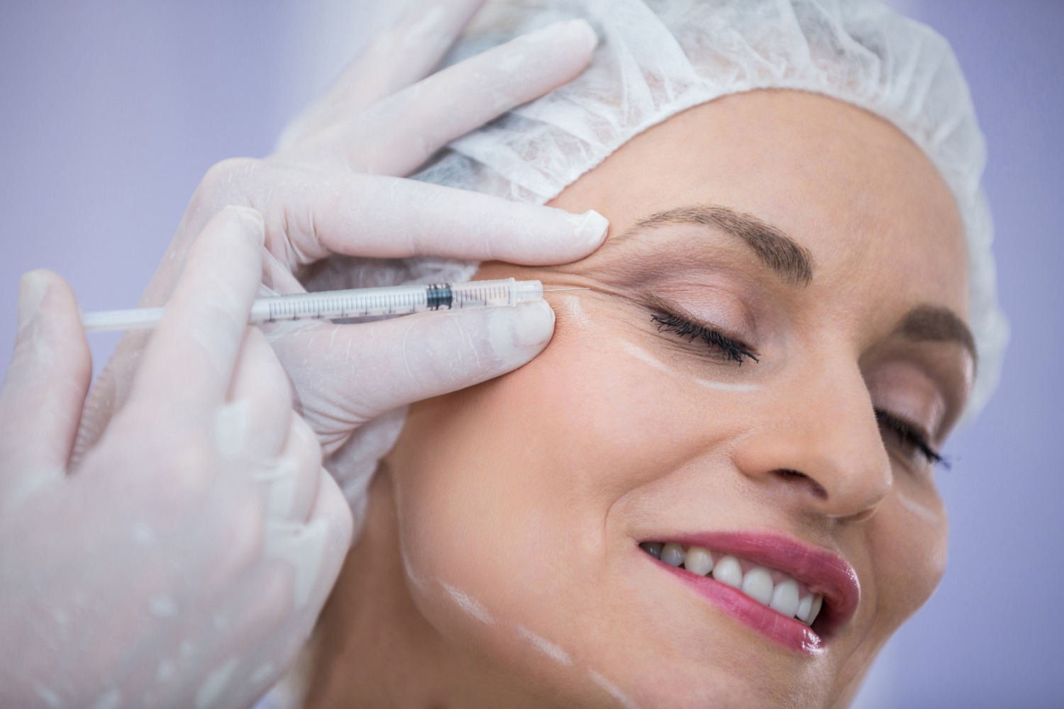 Neuromodulators treatment for wrinkle reduction at Reveal Clinics Riyadh