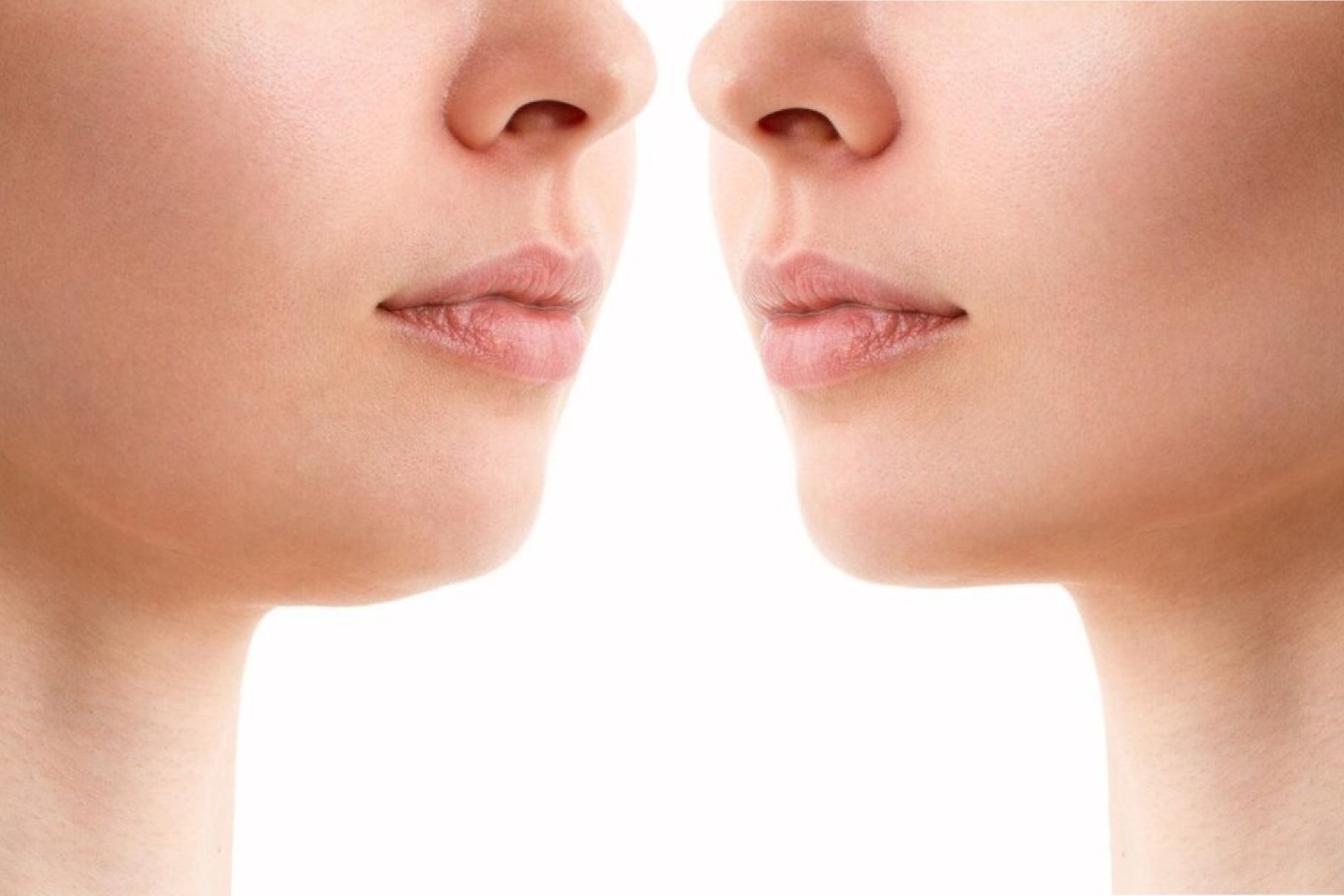 Chin and jawline contouring with fillers at Reveal Clinics Riyadh