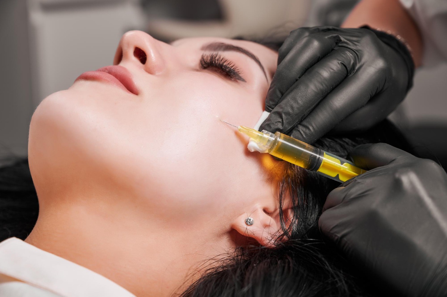 kin rejuvenation injectables including Sculptra, PRP, and Radiesse at Reveal Clinics Riyadh
