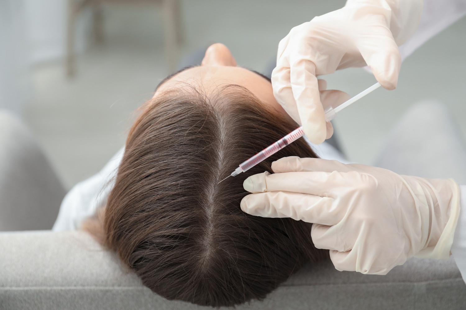 woman with hair loss problem receiving injection in reveal clinics