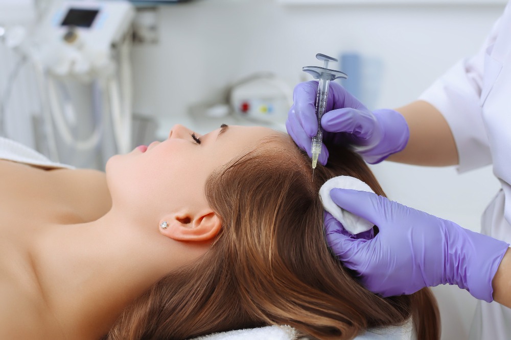 Female Patient getting PRF injection in the scalp for hair restoration at Reveal Clinics