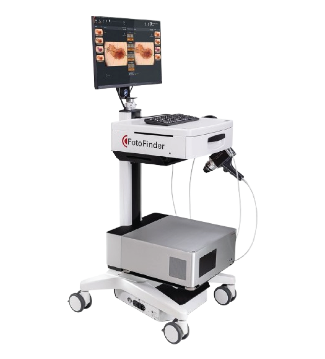 FotoFinder VEXIA hair screening device used for advanced hair and scalp analysis at Reveal Clinics Riyadh