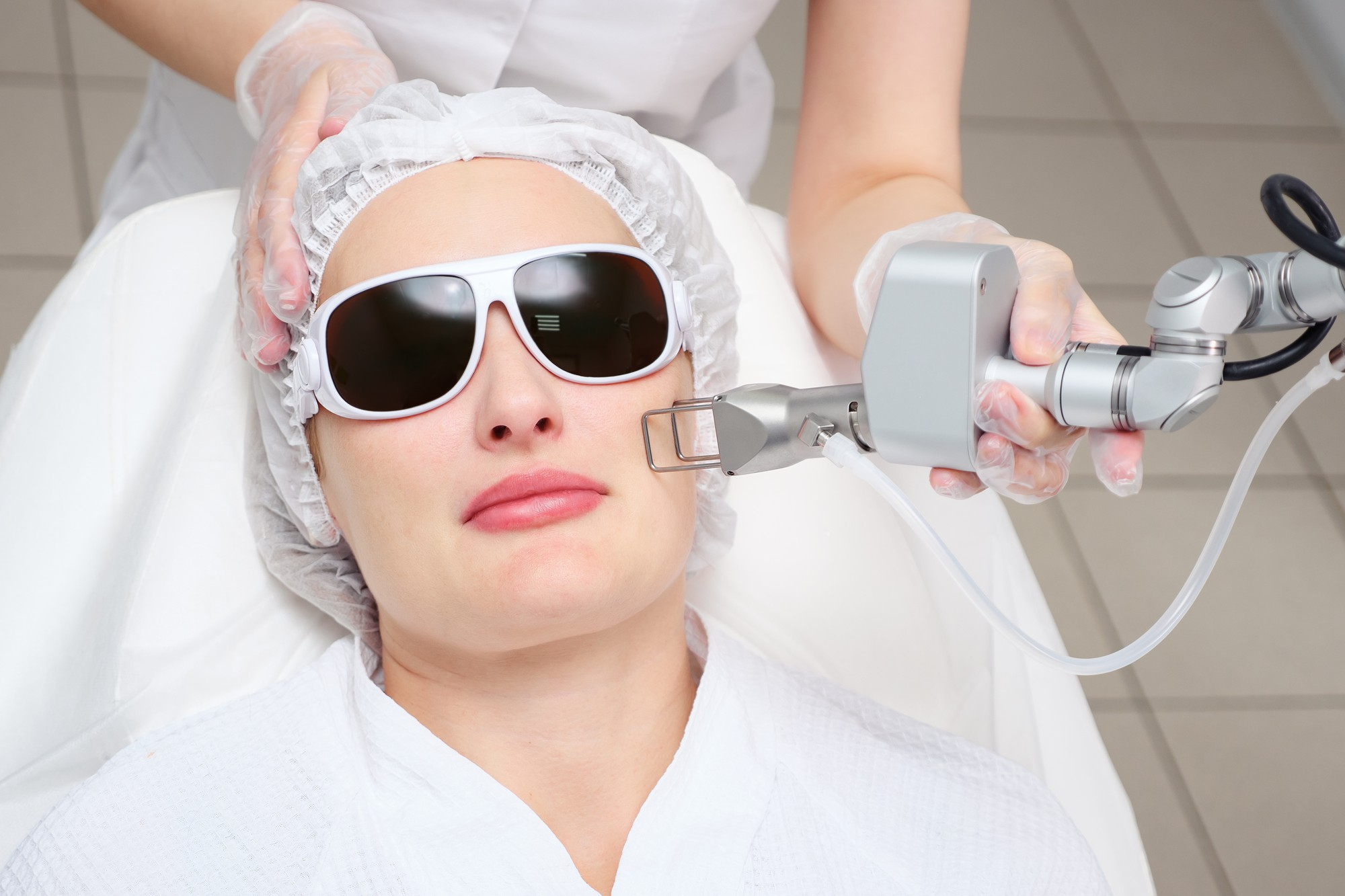 fractional co2 laser resurfacing at reveal clinics riyadh for acne scars and wrinkles