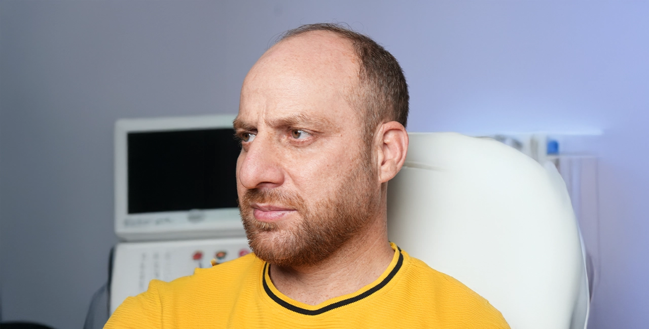 Home 15 After treatment result