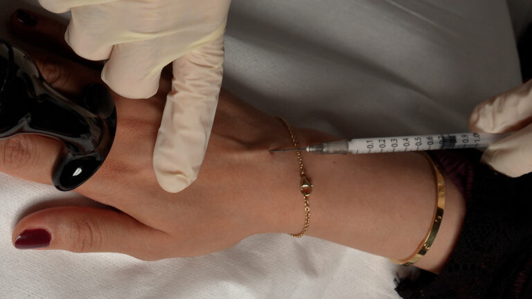 A_RADIESSE_HANDS