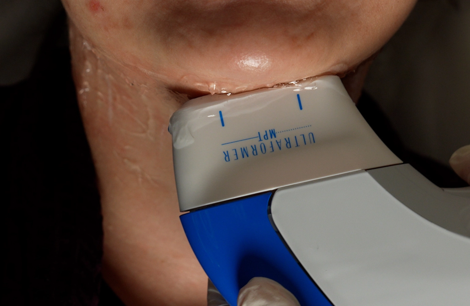 Advanced-Non-Invasive