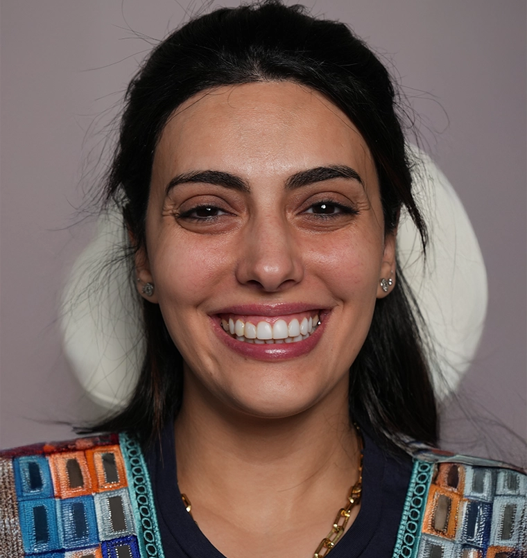 Home 18 Before treatment result