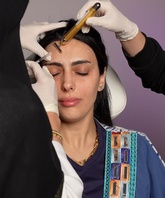 Natural Botox results at Reveal Clinic in Riyadh showing smoother skin and youthful facial rejuvenation without surgery