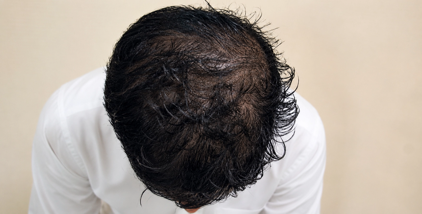 Home 16 Before treatment result