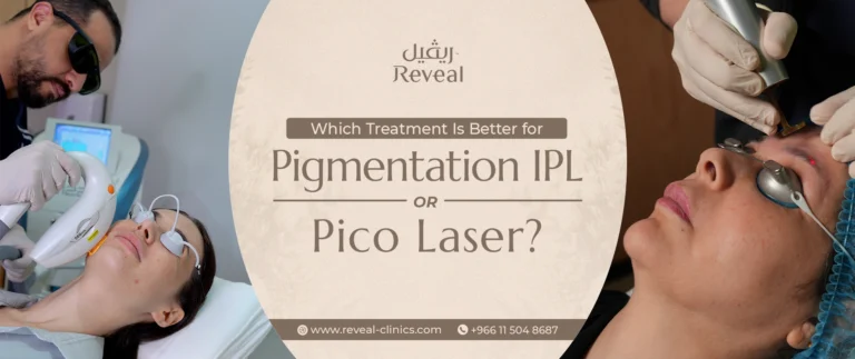 Which Treatment Is Better for Pigmentation IPL or Pico Laser
