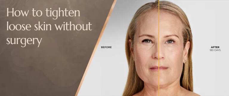 how to tighten loose skin without surgery