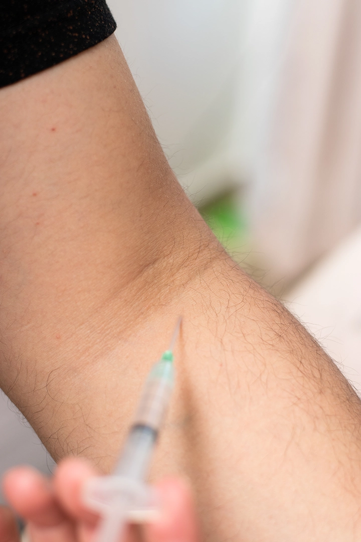 Hyperhidrosis Botox Treatment 1 side banner image copy