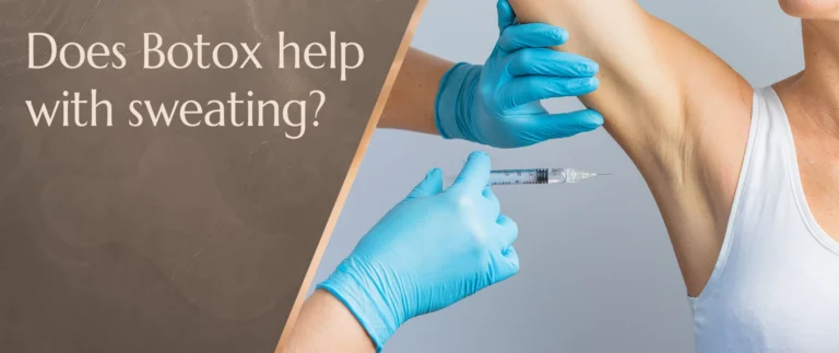 does botox help with sweating